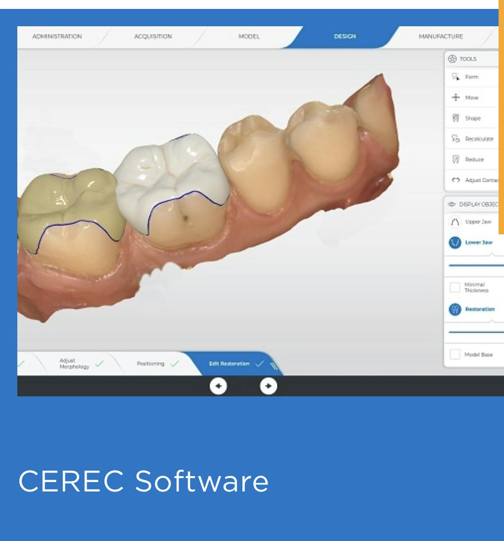 CEREC - Technology - Dentist North York - Sky Dental